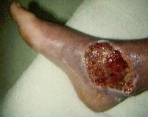 bite6.jpg